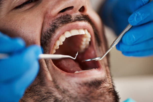 Best Broken or Cracked Tooth Emergency Dentist in Hden Springs, ID